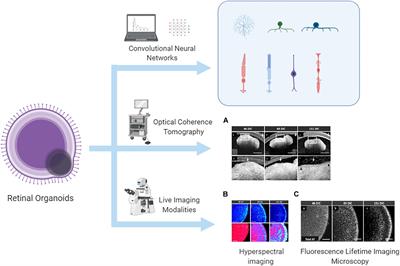 Retinal Organoids: Cultivation, Differentiation, and Transplantation